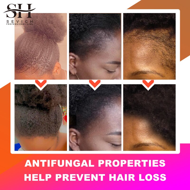 Chebe Hair Growth Spray African Hair Thickening Oil
