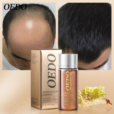 Hair Growth Ginseng Hair Essence Oil