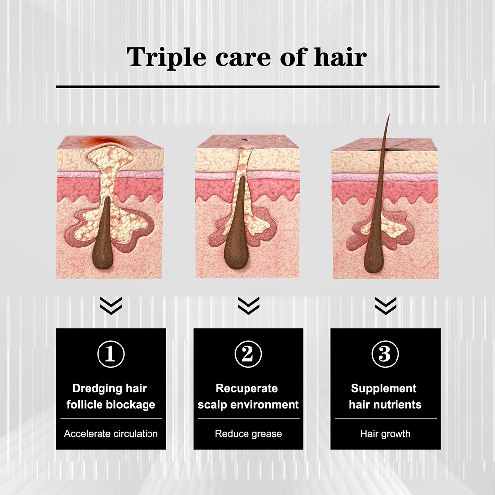 Anti-Shedding and Anti Hairloss Hair Spray with Plant Extracts